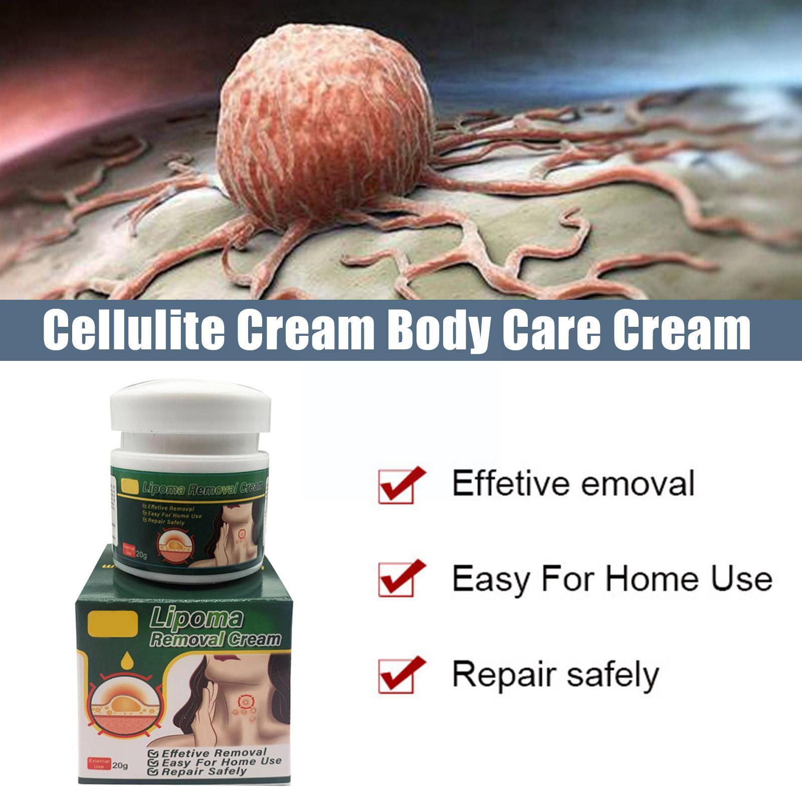 Multiple Anti-tumor Lipoma Pain Cream