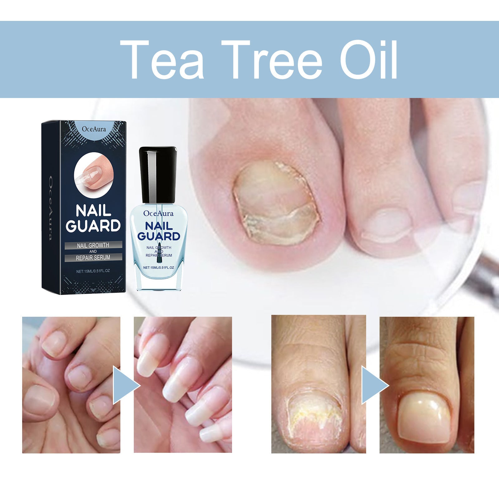 OnyxoGuard Nail Growth and Repair Serum