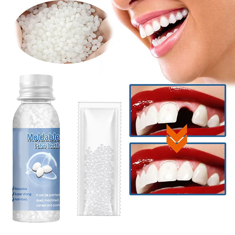🦷2024 HOT SALE-49% OFF🦷 Temporary Tooth Sculptor Repair Kit