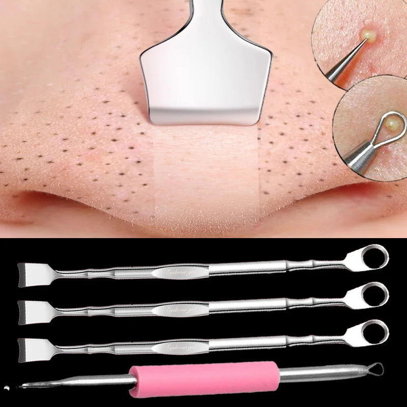 Pimple Popper Tool Blackhead Remover Acne Needle Removing Treatment Comedone Whitehead Popping Zit Nose Face Blemish Extractor