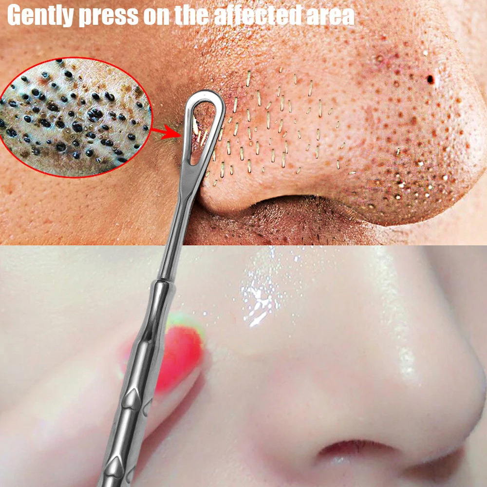 Pimple Popper Tool Blackhead Remover Acne Needle Removing Treatment Comedone Whitehead Popping Zit Nose Face Blemish Extractor