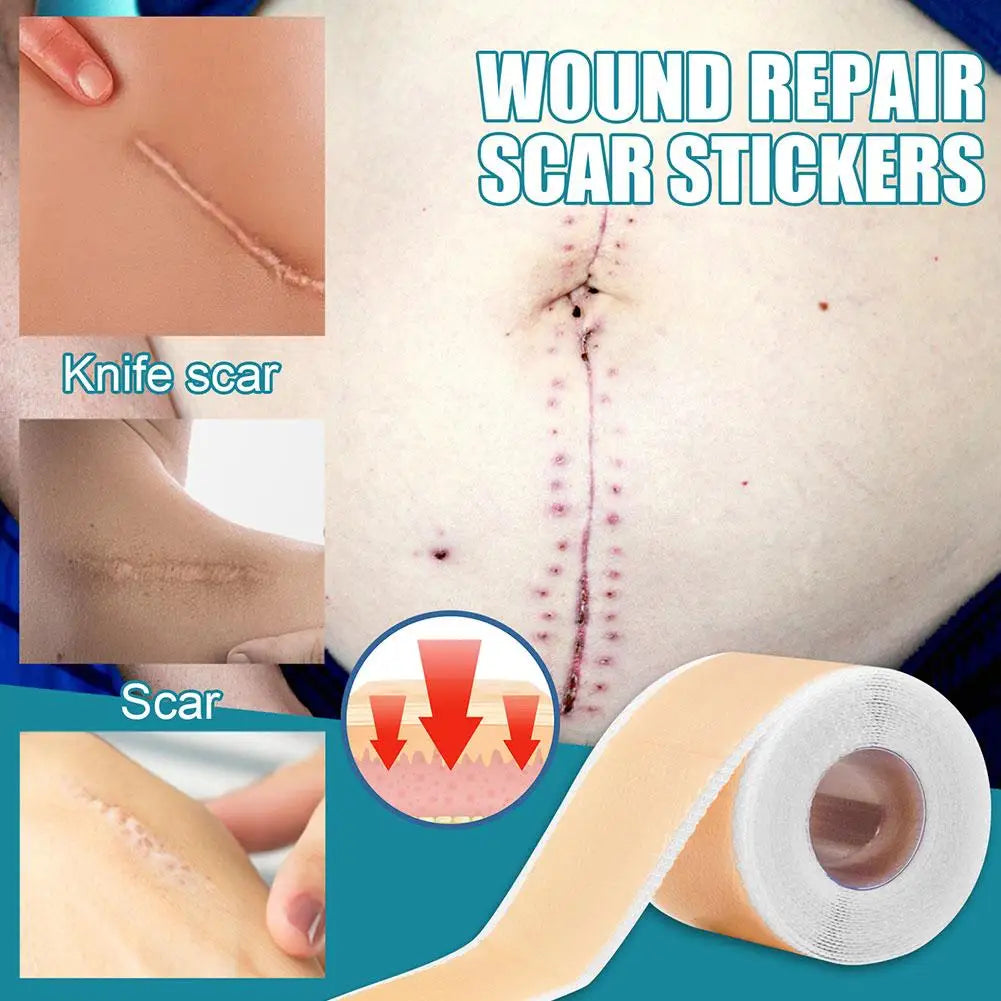 Silicone Scar Sheet Patch