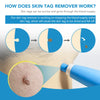 2 IN 1 Auto Skin Tag Remover