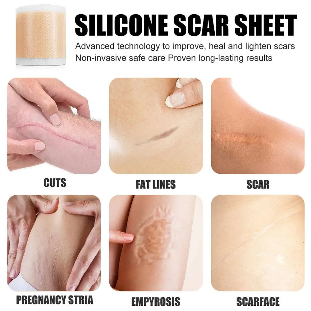 Silicone Scar Sheet Patch