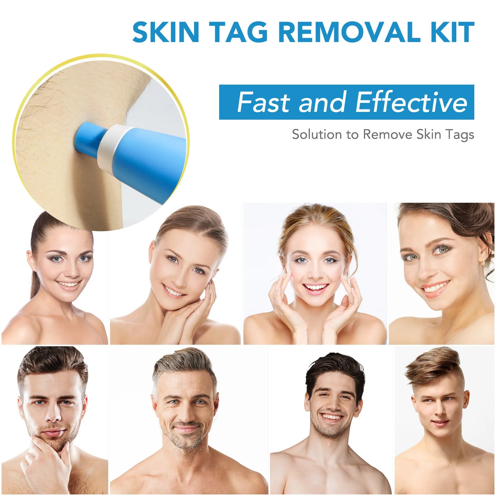 2 IN 1 Auto Skin Tag Remover