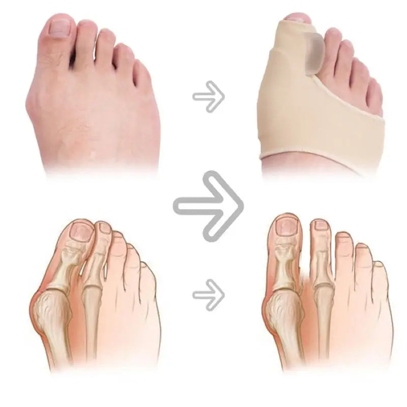 Premium Bunion Corrector Sock