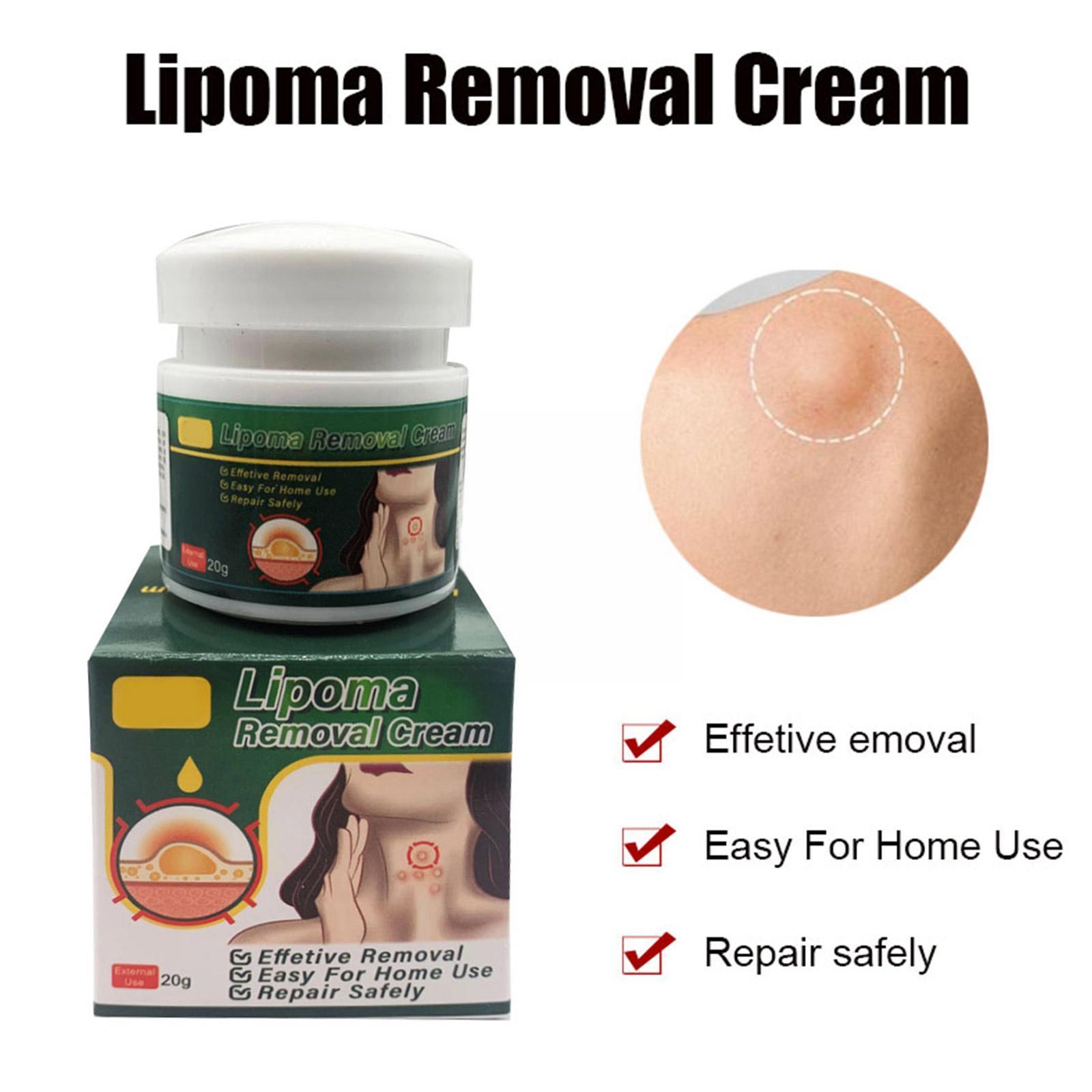 Multiple Anti-tumor Lipoma Pain Cream