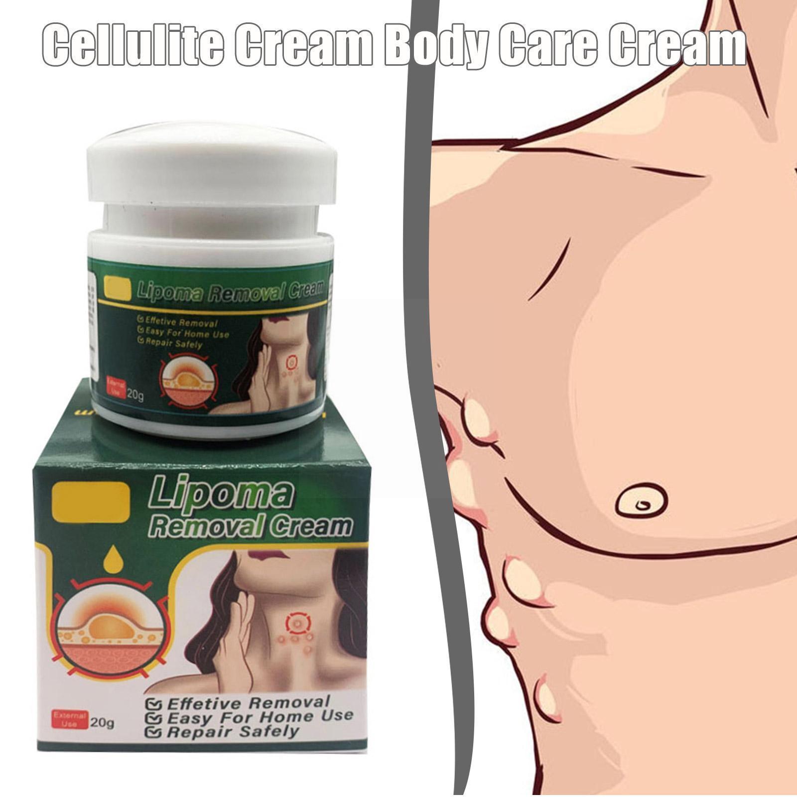 Multiple Anti-tumor Lipoma Pain Cream